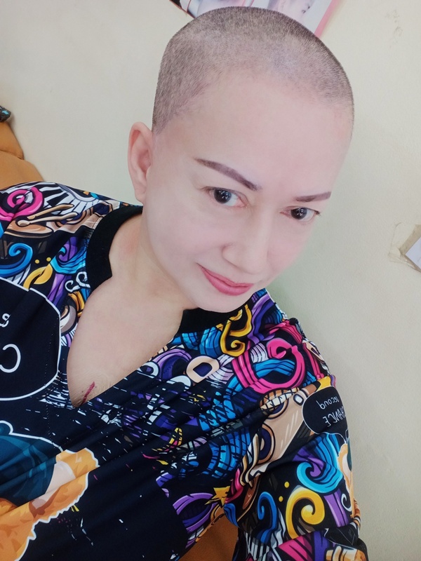 อัปเดตภาพ แหม่ม อลิษา ล่าสุด โกนหัวสู้มะเร็งปอดลามระยะ 4