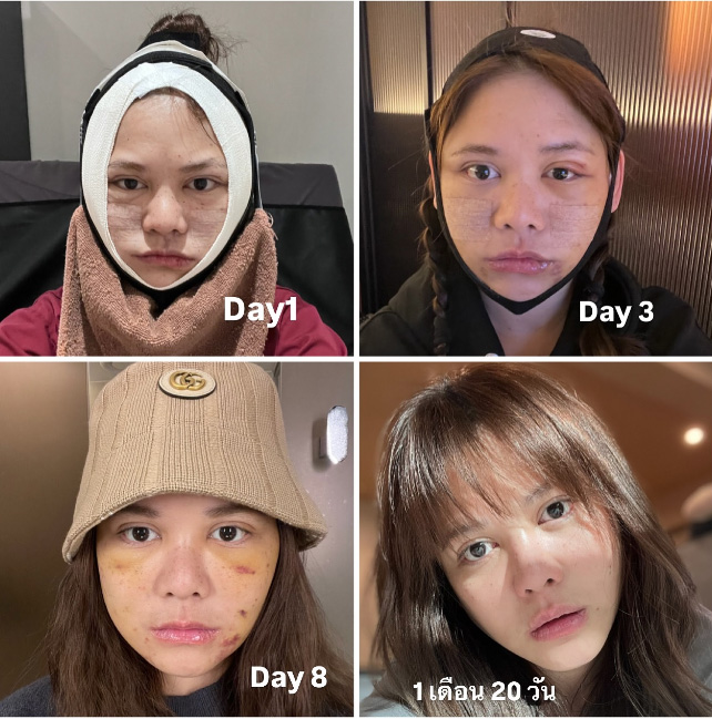 ส่องภาพก่อน-หลังศัลยกรรม พิมพ์ พิมพ์มาดา ในวัย 45 ปี สวยกระชากวัยมาก