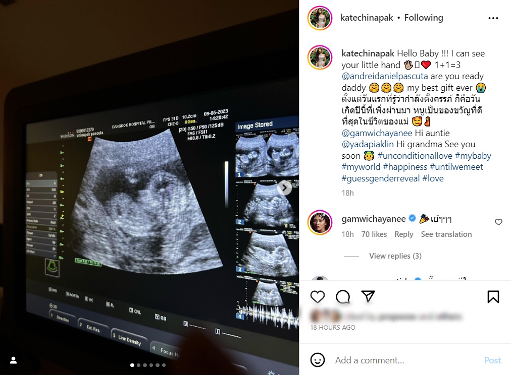 เกศ จิณภัค น้องสาว แก้ม เดอะสตาร์ 