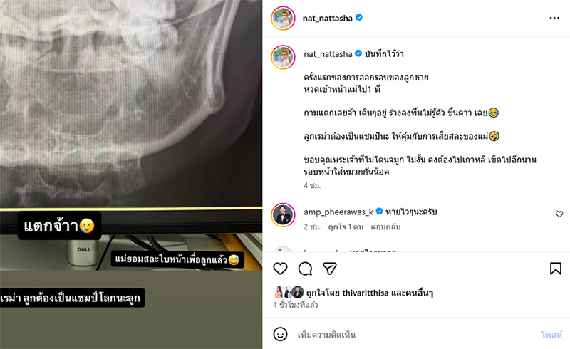 แนท ณัฐชา