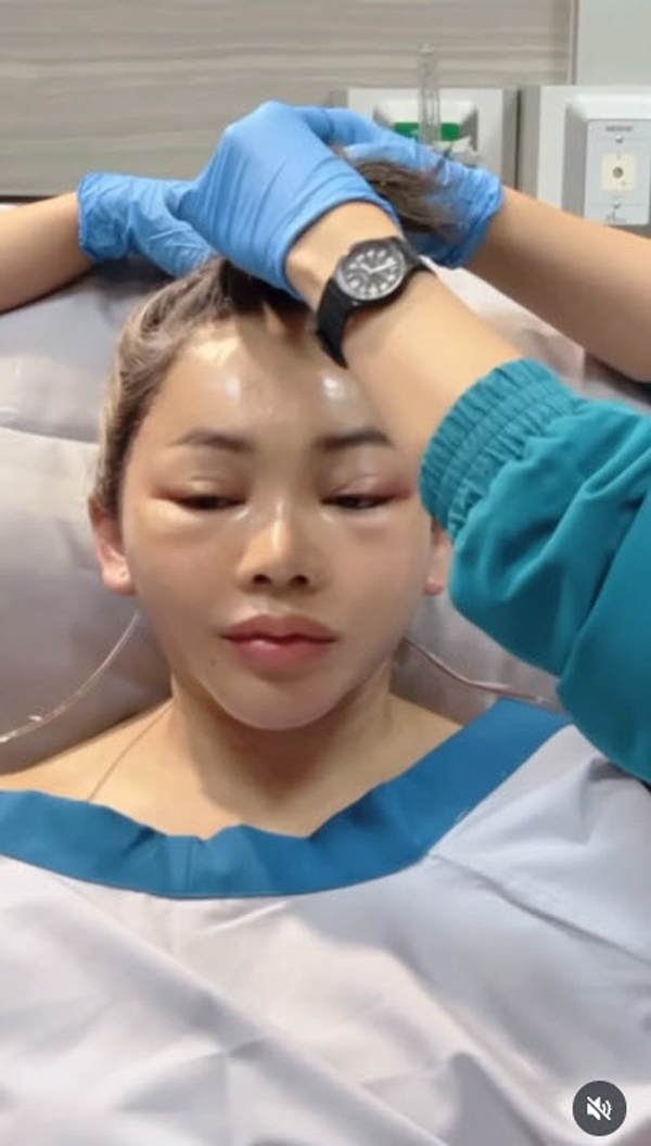 ตั๊กแตน ศัลยกรรมหน้า