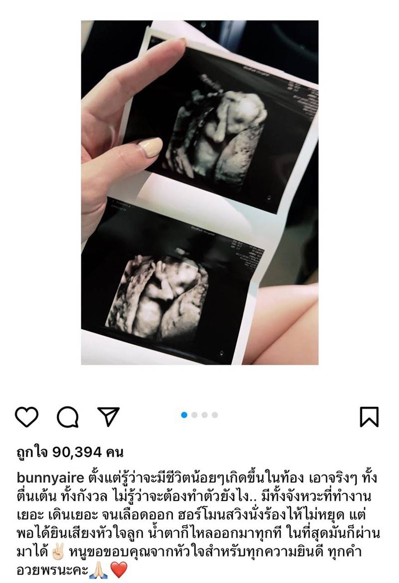 แอร์ ภัณฑิลา ท้อง