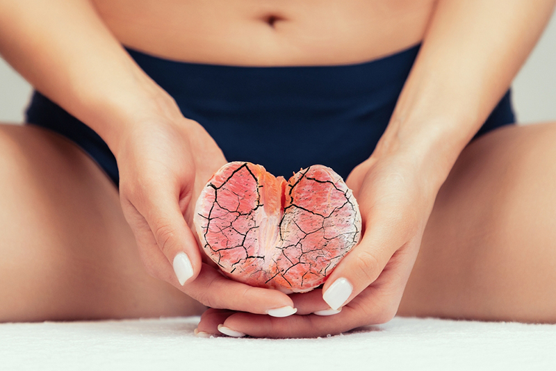 ช่องคลอดแห้ง