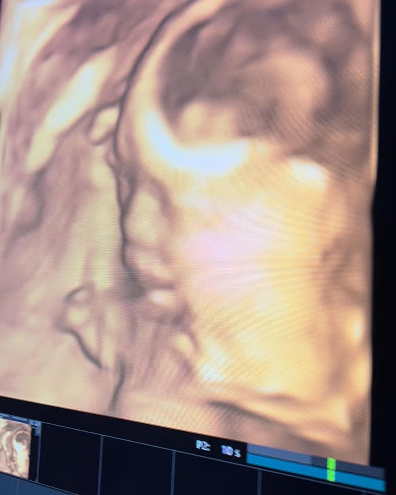 น้องยูจิน