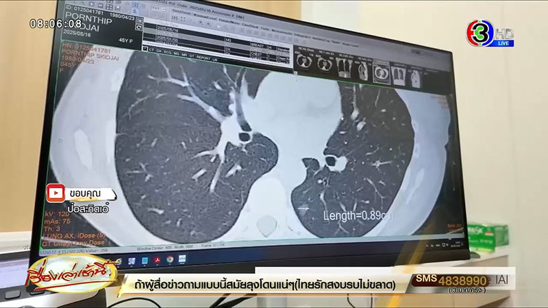 เอ๋ พรทิพย์