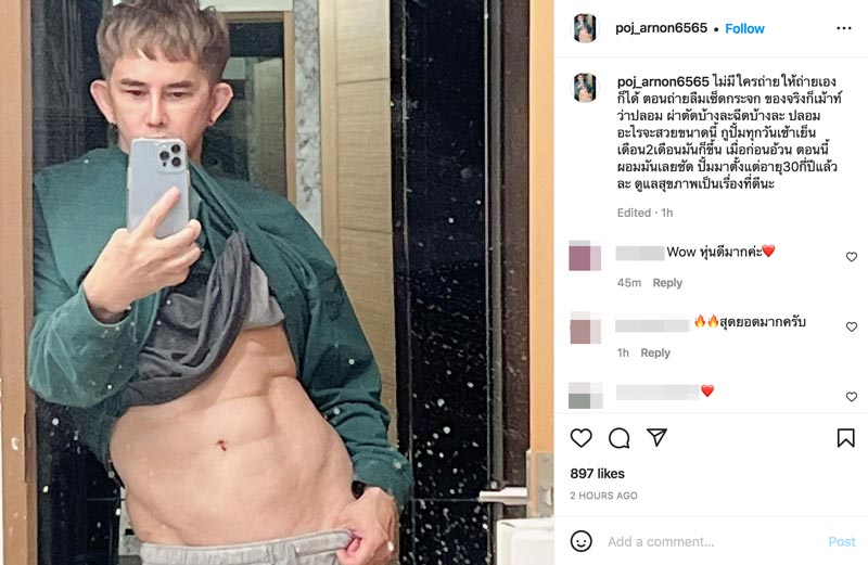 พชร์ อานนท์