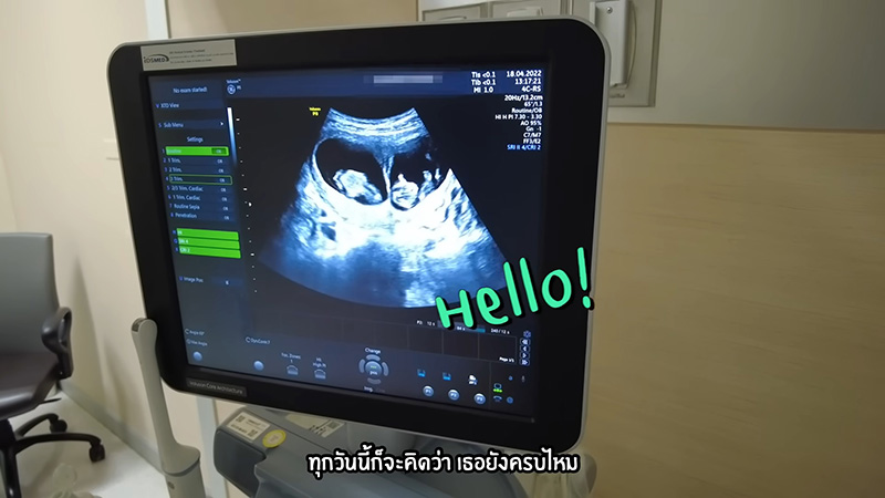 ลูก บีม กวี ออย อฏิพรณ์