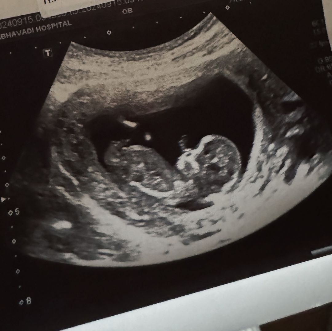 แพร เอมเมอรี่