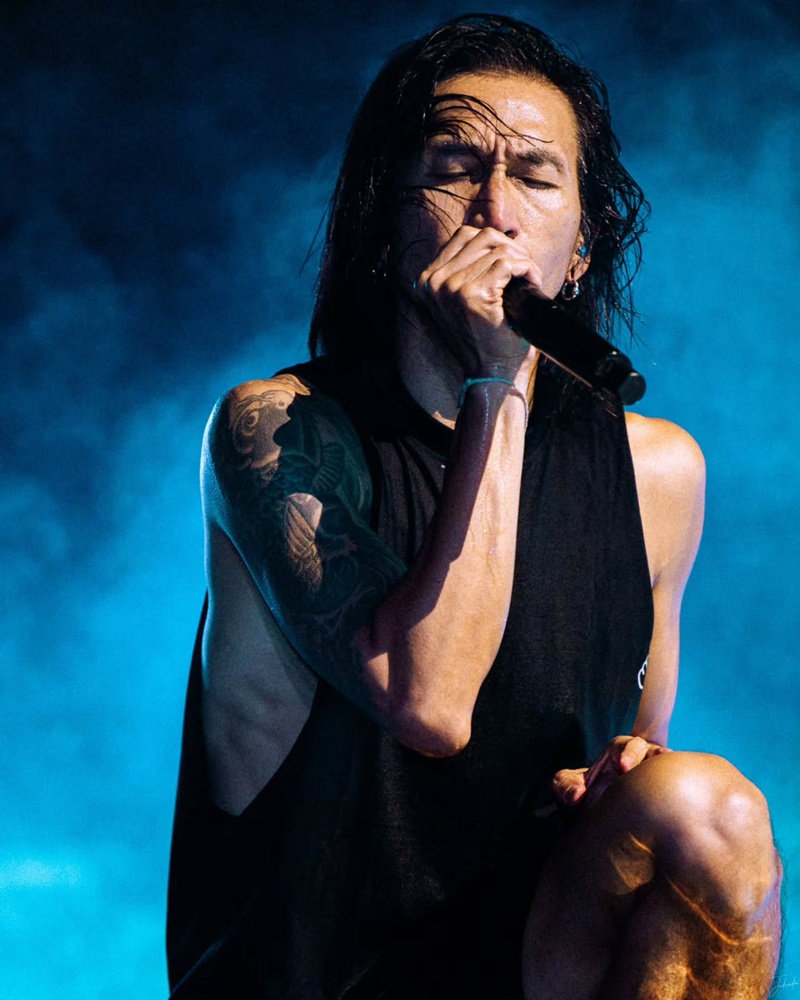 ตูน บอดี้สแลม เข้าผ่าตัดกระดูกคอกดทับเส้นประสาท