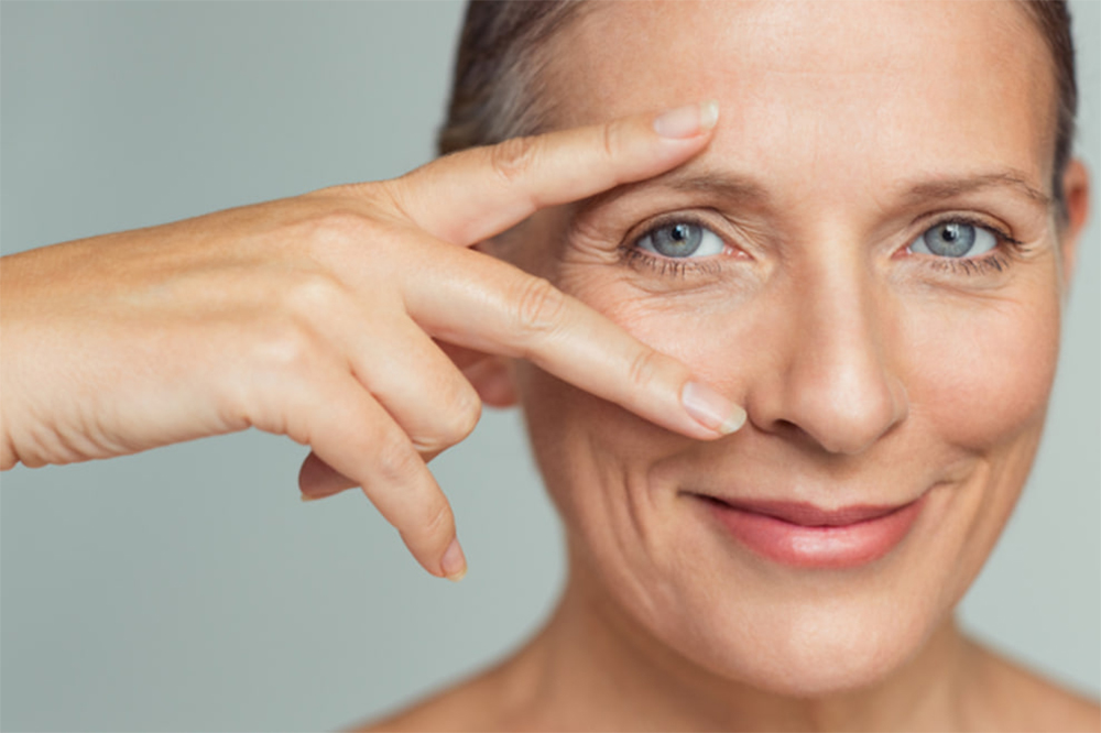 Subbrow Lift แผลซ่อนใต้คิ้ว