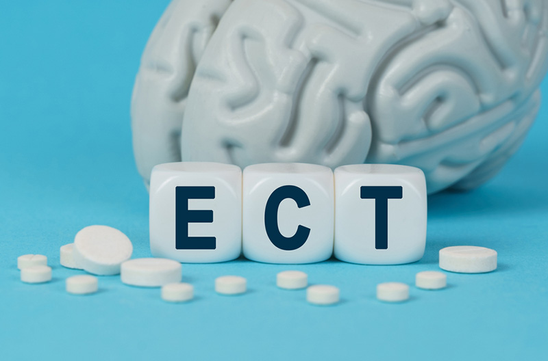Electroconvulsive Therapy