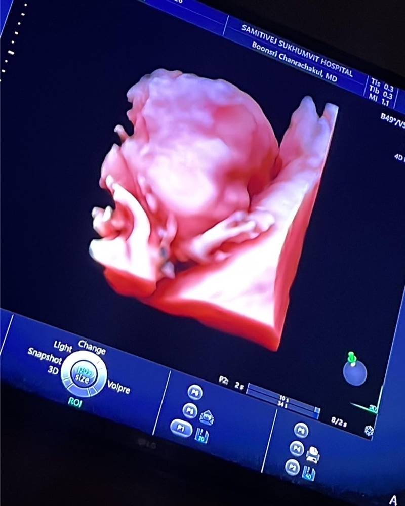 จินนี่ จุฑาภัค ท้อง