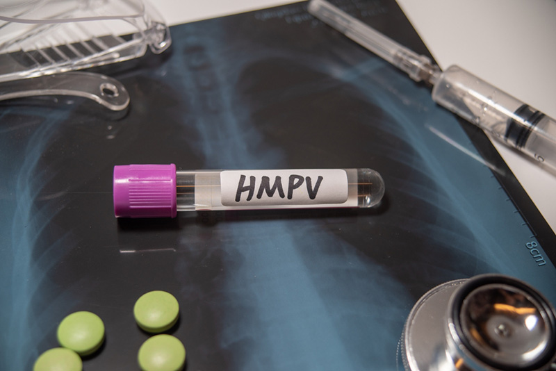 ไวรัส hMPV