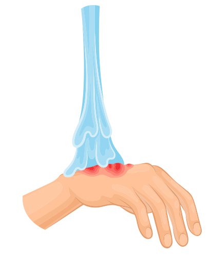 ทำนายฝัน ฝันว่าโดนน้ำร้อนสาด หมายความว่าอะไร พร้อมตีเลขเด็ด