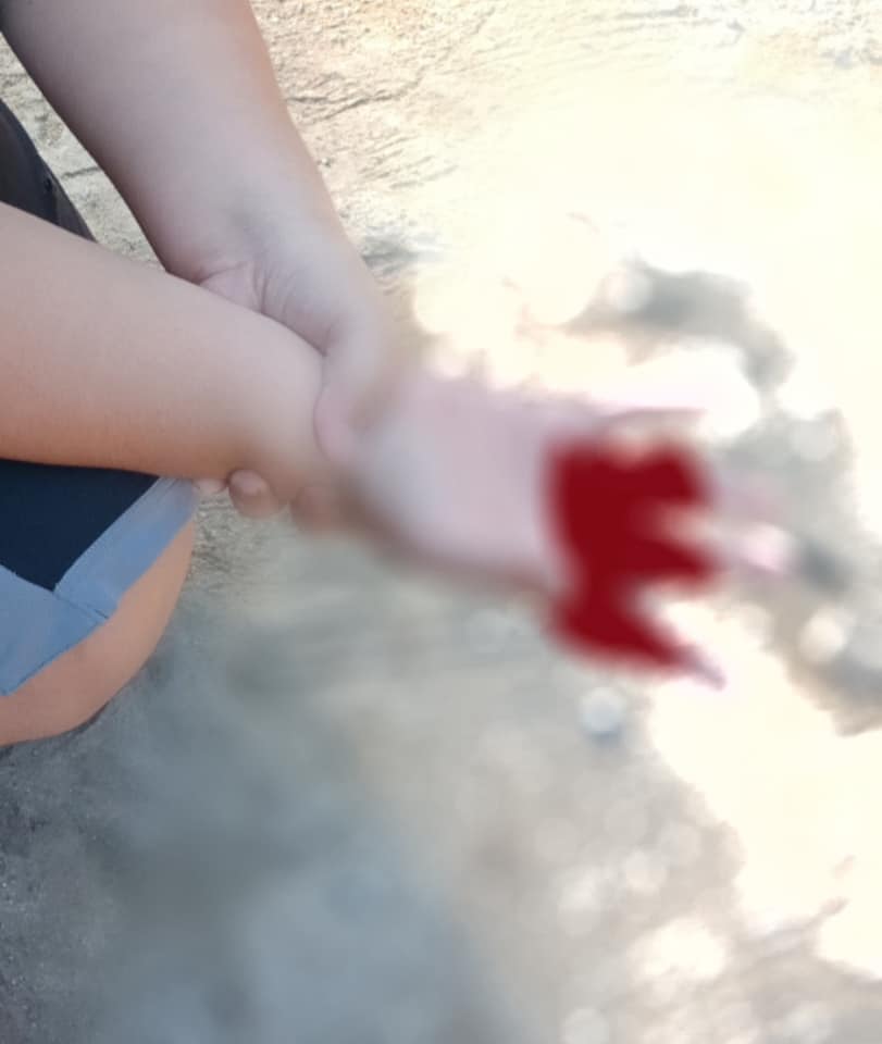 ประทัดกระเทียม