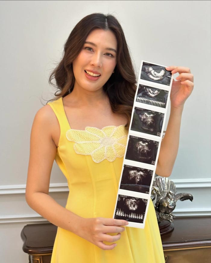 บี มาติกา ท้อง