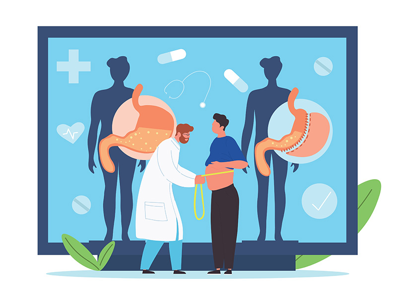 ผ่าตัดกระเพาะอาหารลดน้ําหนัก