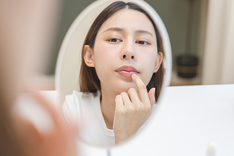 ปากแห้งลอก