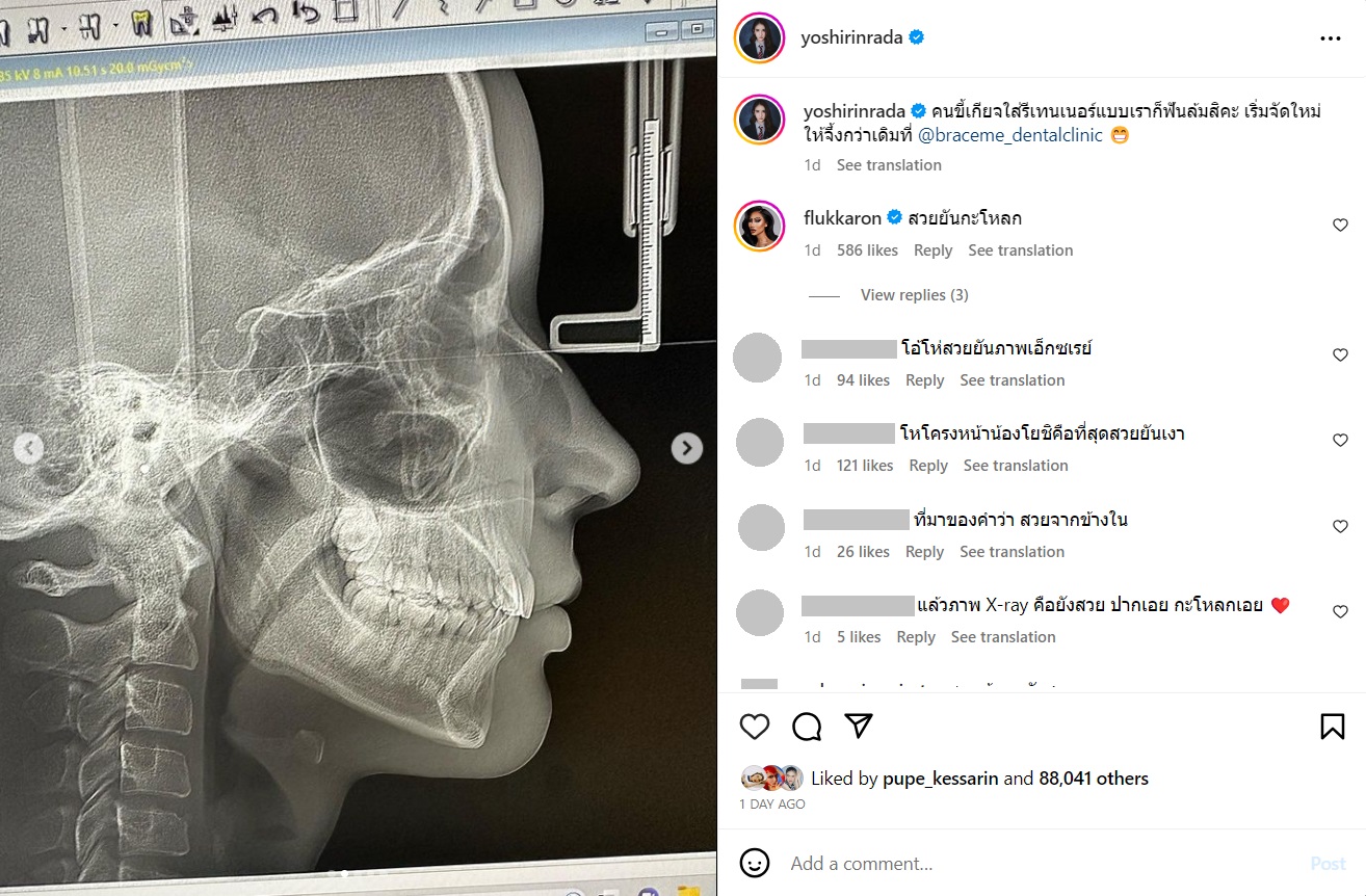 โยชิ รินรดา