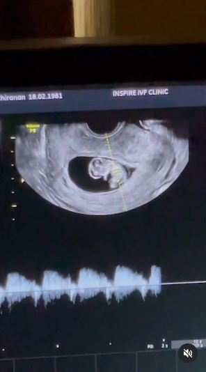 ยุ้ย จีรนันท์