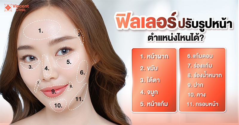 ฟิลเลอร์ ช่วยเรื่องอะไรบ้าง เหมาะกับใคร ฉีดบริเวณไหนได้บ้าง ?