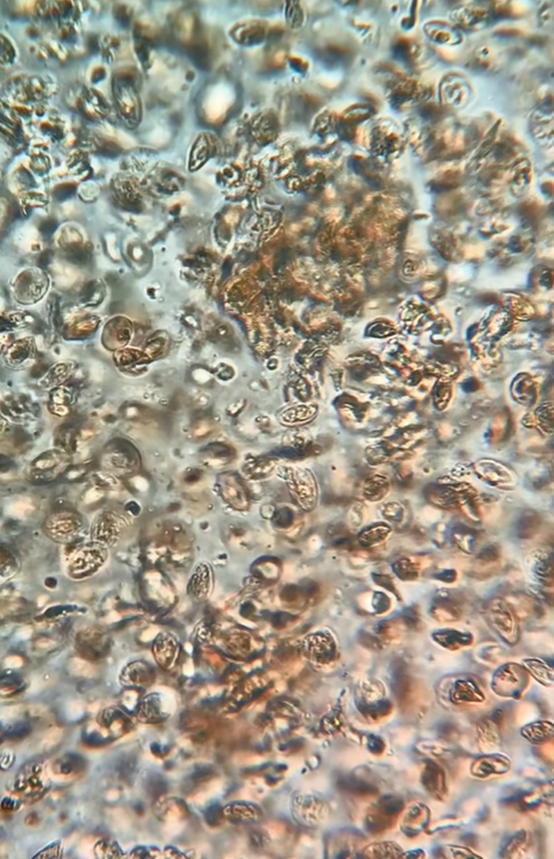 หอยแครง