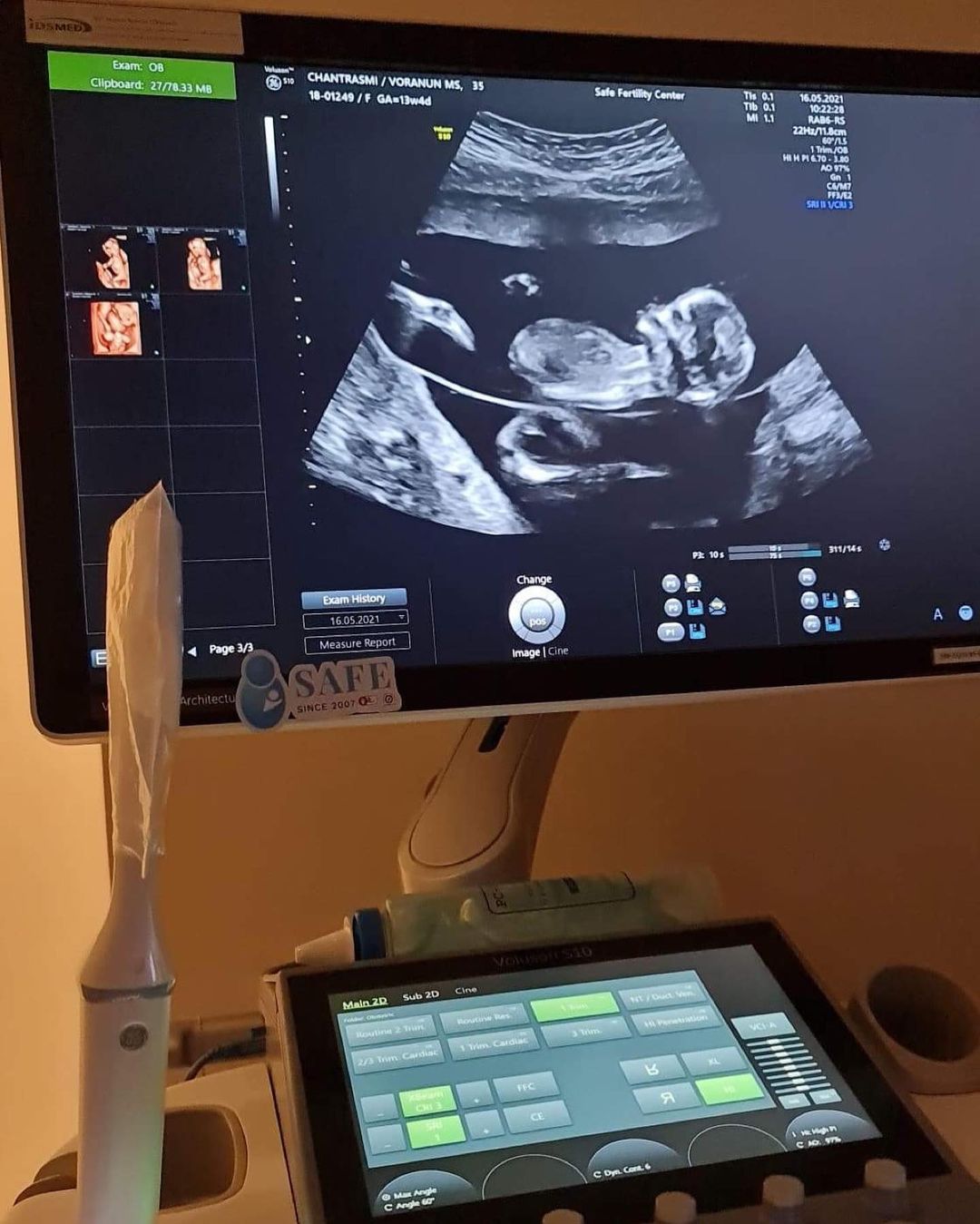 จุ้มจิ้ม วรนันท์ ภัทร