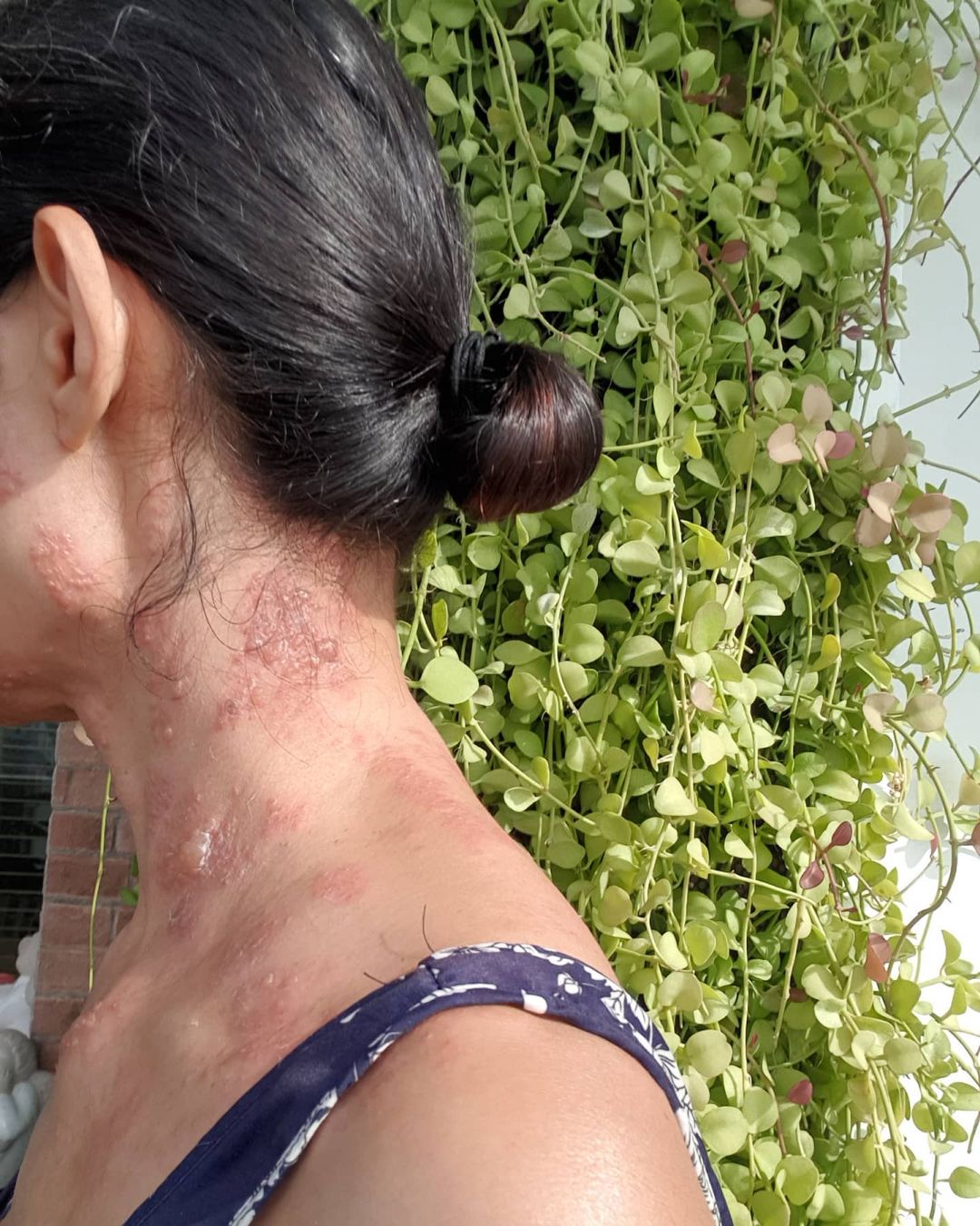 ดี้ ชนานา