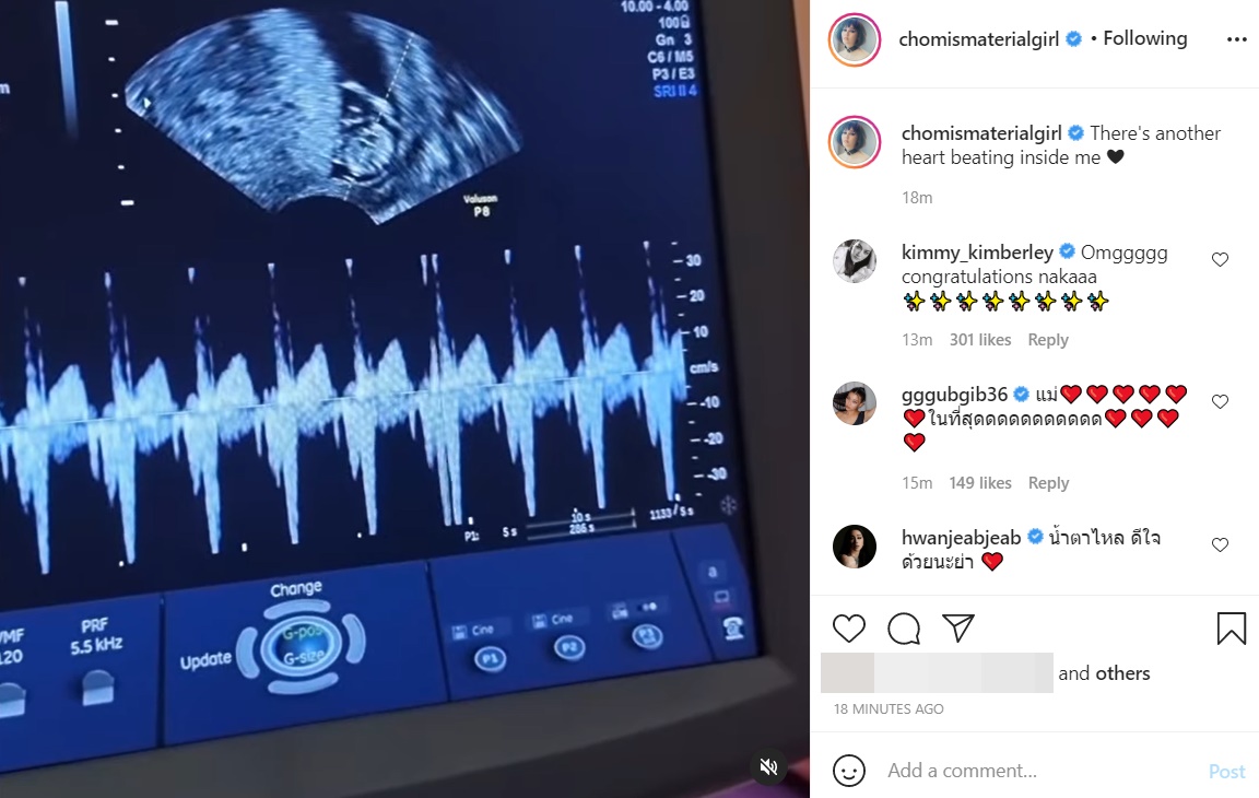 ชมพู่ อารยา