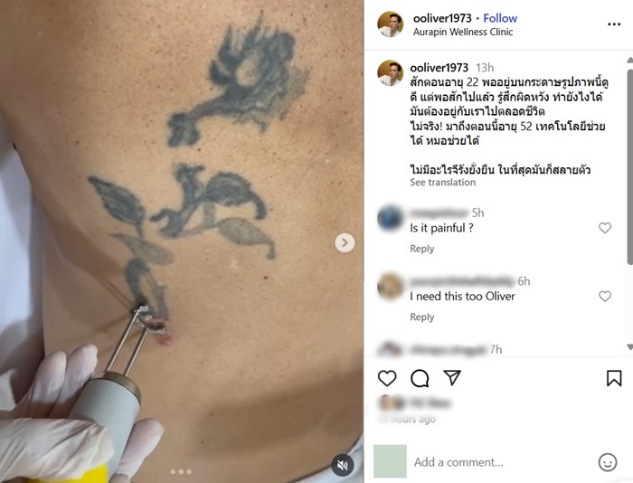 อั๋น โอลิเวอร์ 