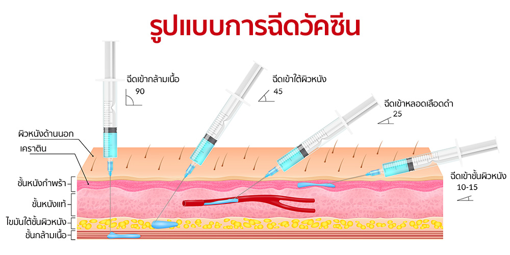 ฉีดวัคซีนโควิด