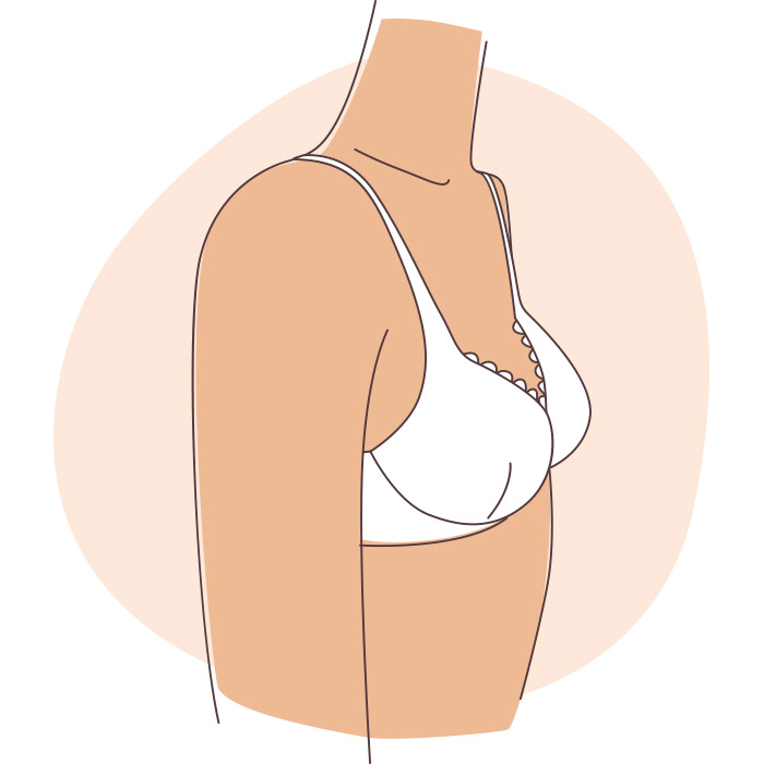 หน้าอกหย่อนคล้อย