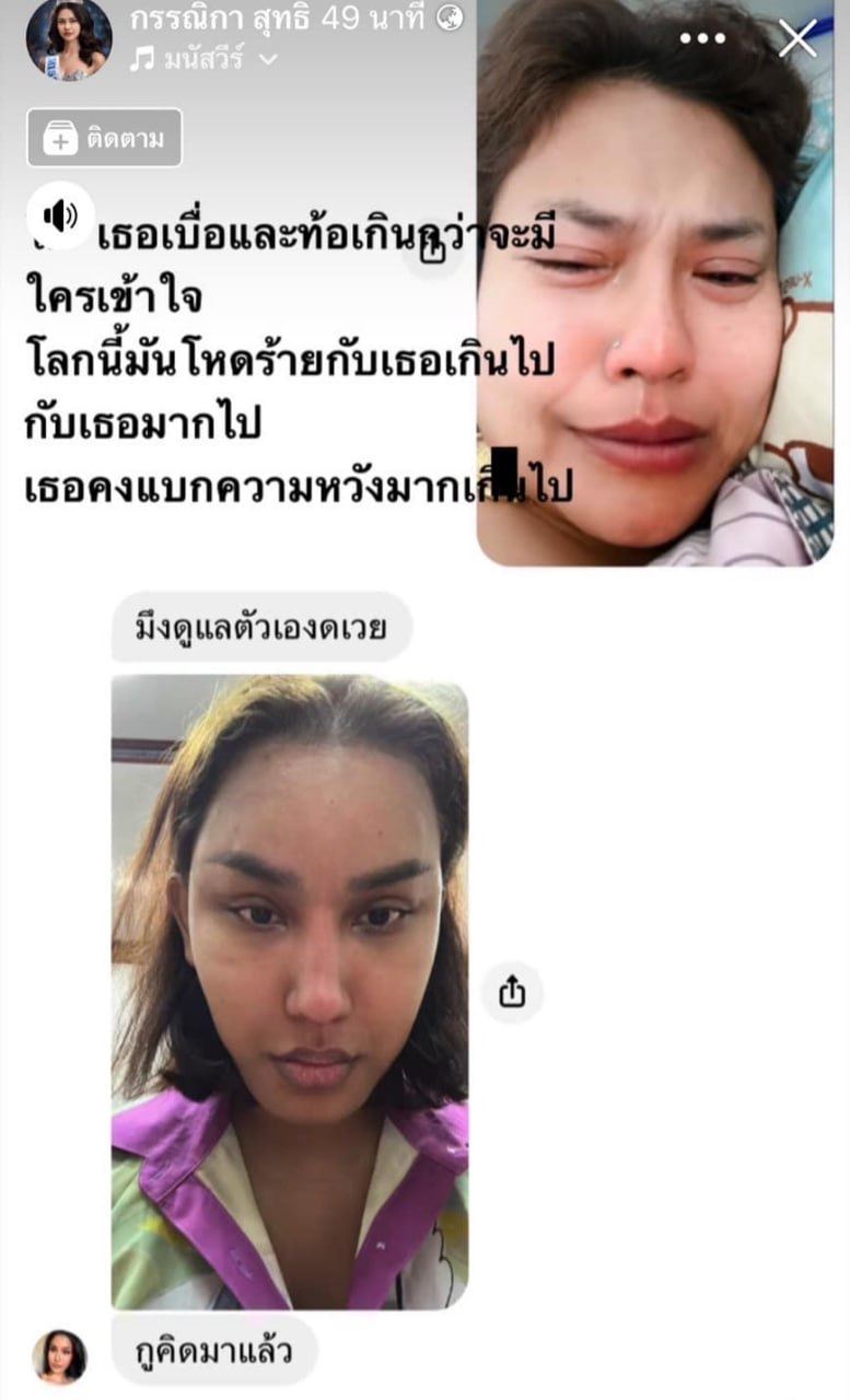 แอนนา ทีวีพูล