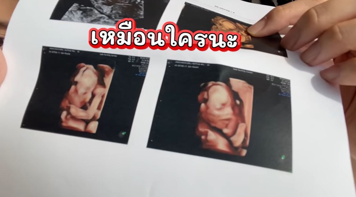 มิว นิษฐา 