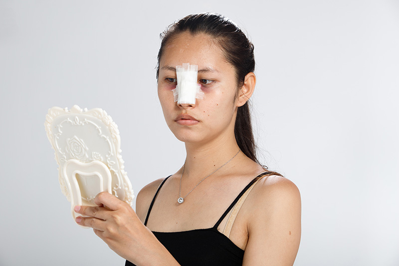 ศัลกรรมหน้าพัง