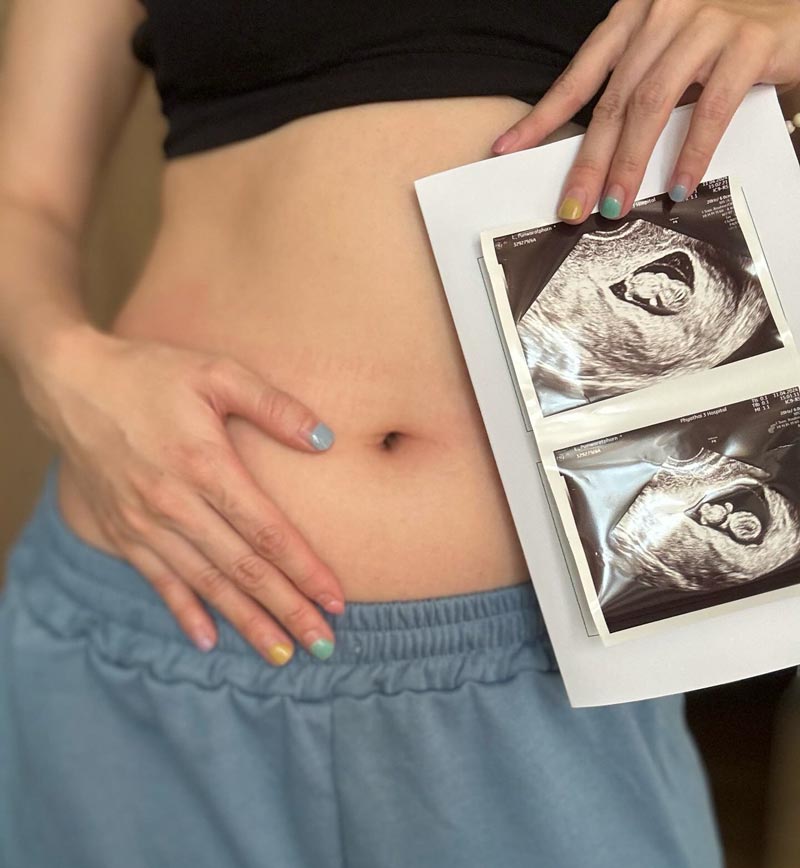 เบลล์ เกิร์ลลี่ เบอร์รี่ ท้อง