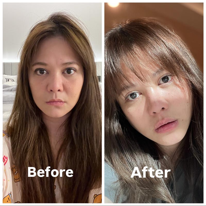 เทียบรูป พิมพ์ พิมพ์มาดา รีวิวทำศัลยกรรมยกหน้าใหม่