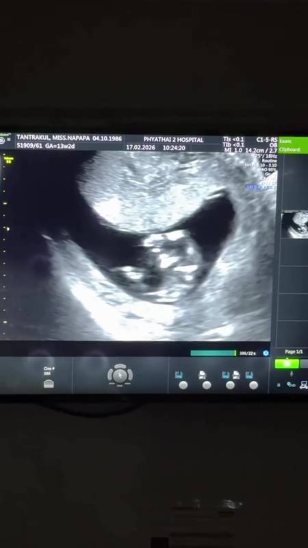 แพท ณปภา ตั้งท้องลูกคนที่สอง