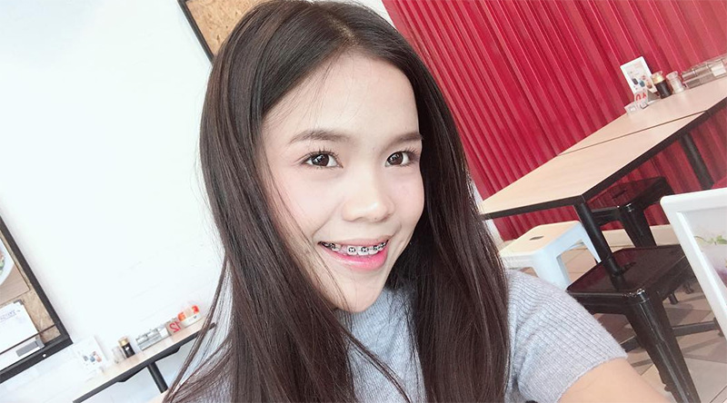 อาม ชุติมา ศัลยกรรมอะไรมาบ้าง เปิดภาพหน้าเก่า VS หน้าใหม่