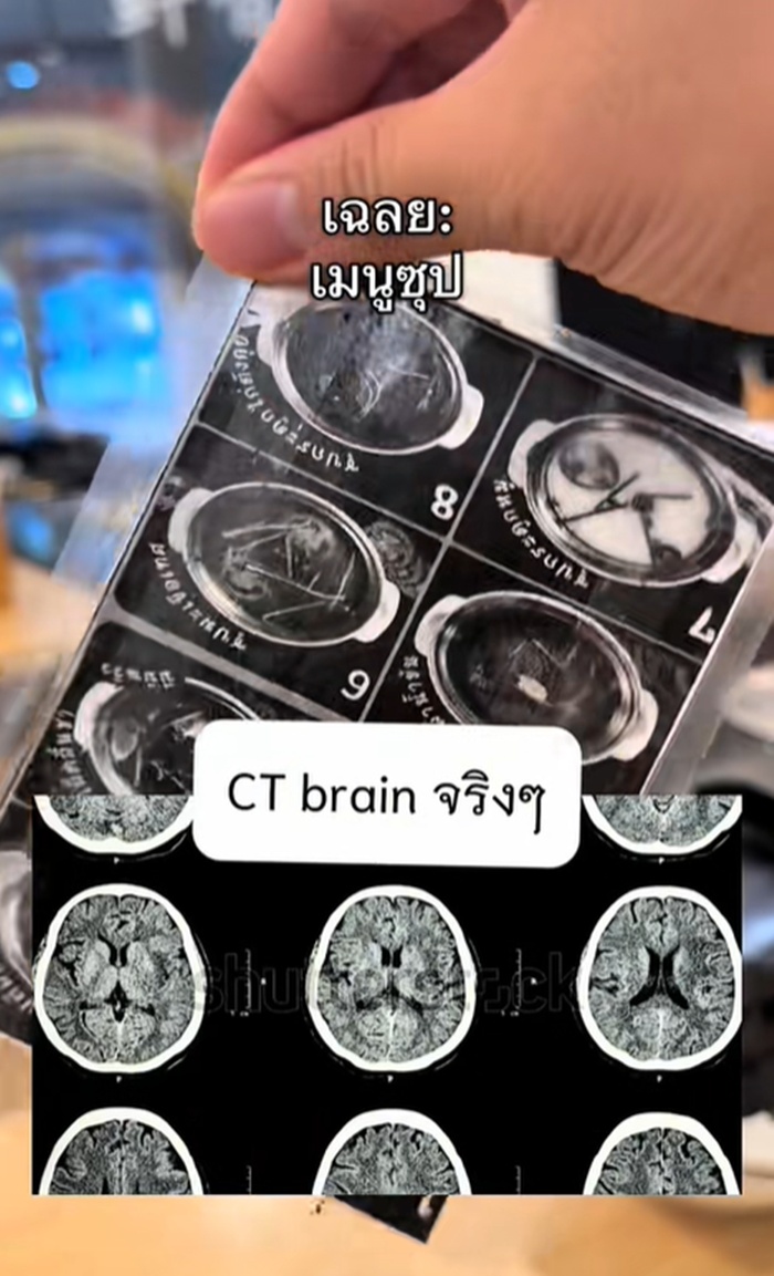 ซีทีสแกน