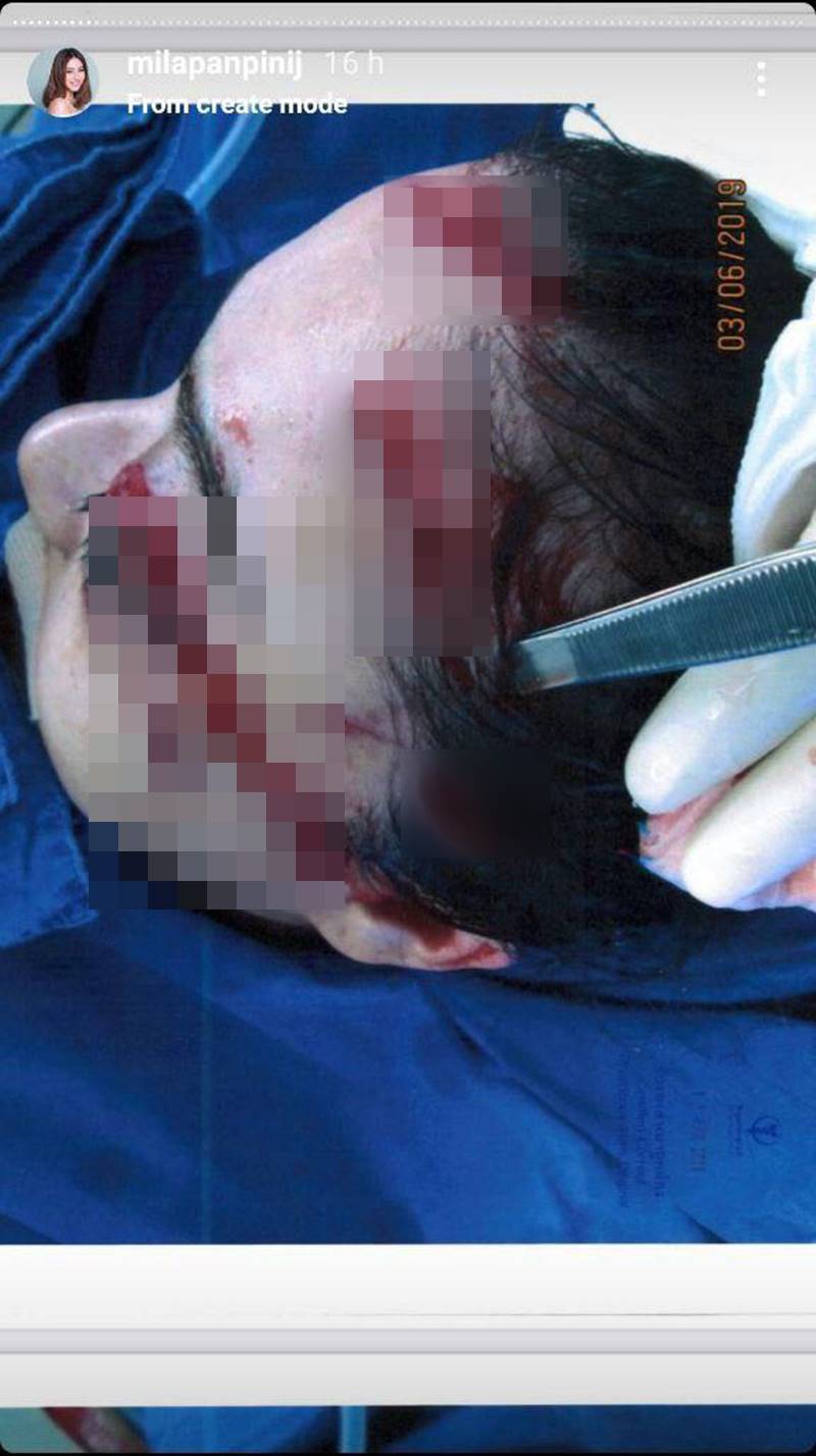 มิล่า กามิกาเซ่