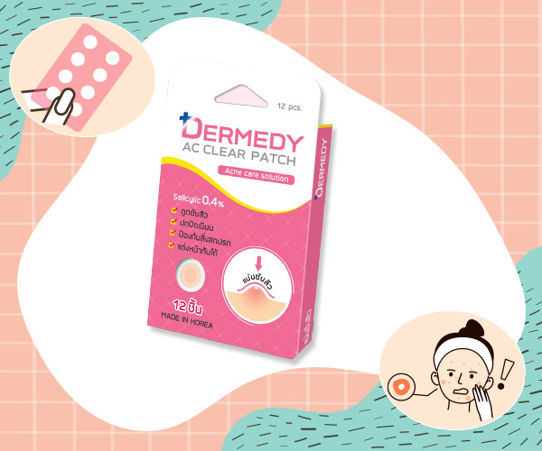 วิธีรักษาสิว