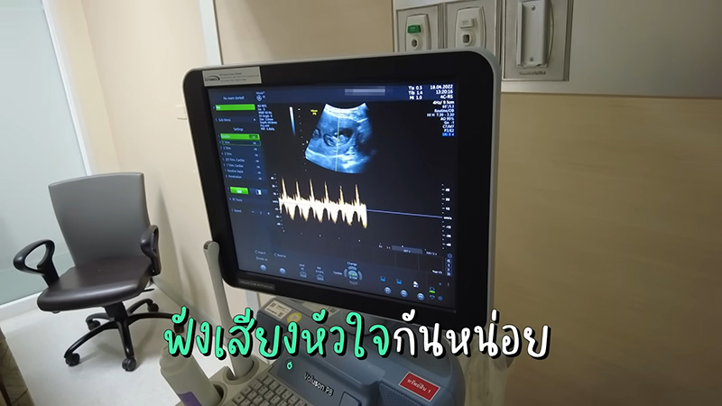 ลูก บีม กวี ออย อฏิพรณ์