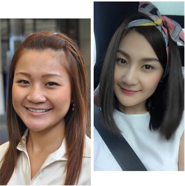 เอ็ม บุษราคัม ดาราศัลยกรรม