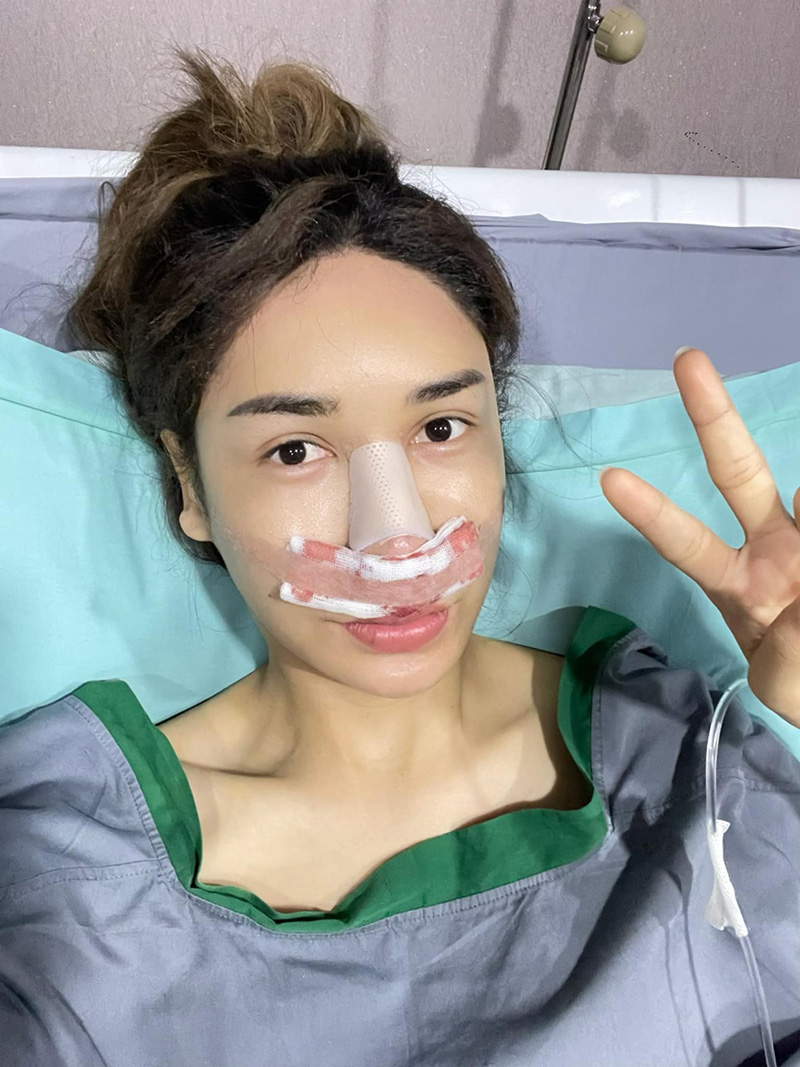 บาสตี้ เน็ตไอดอลสาวสอง