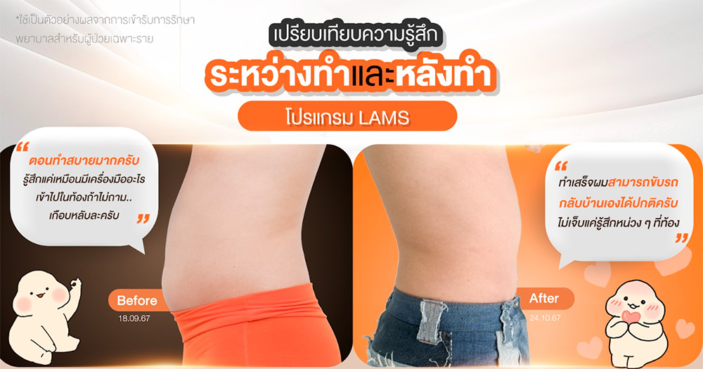 ดูดไขมัน