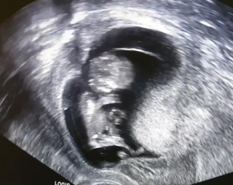 ดีเจป๊อป กิตติพงศ์