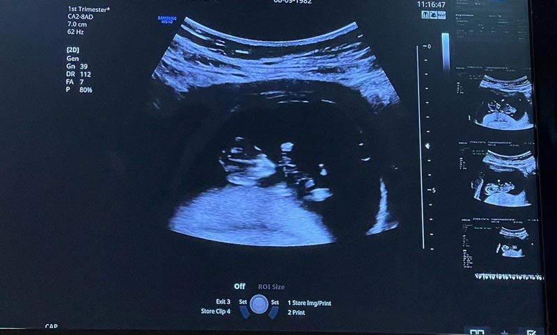 แยม ธมลพรรณ์