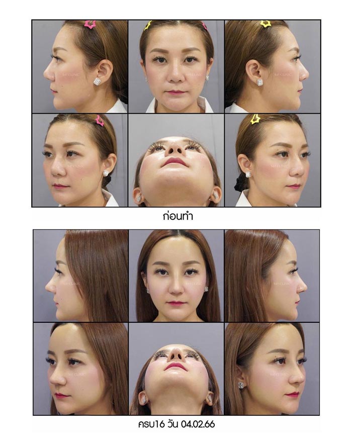 เอ็ม บุษราคัม