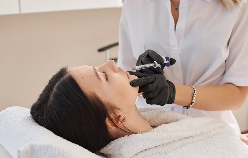 โบท็อกซ์, ฉีดฟิลเลอร์